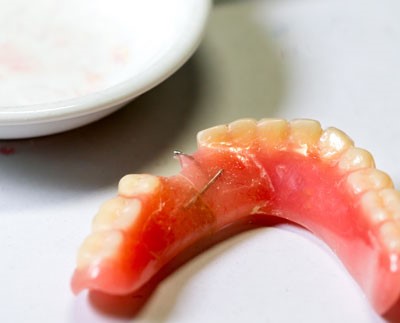 Jaw Registration For 
      Partial Dentures Warminster PA 18974